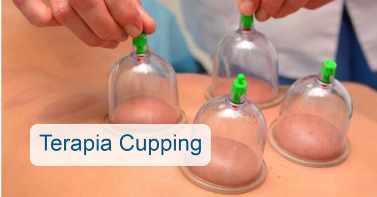 Terapia Cupping & Floss